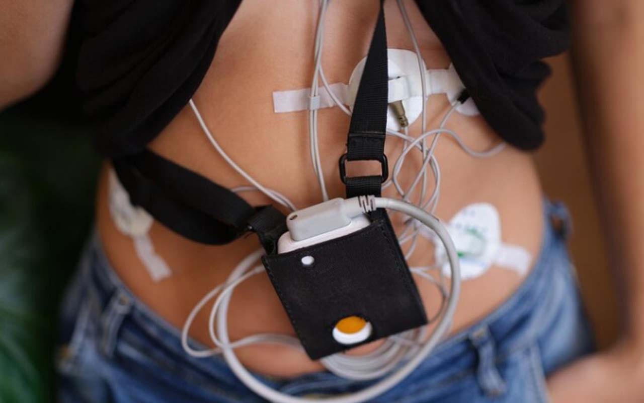 Holter dijagnostika