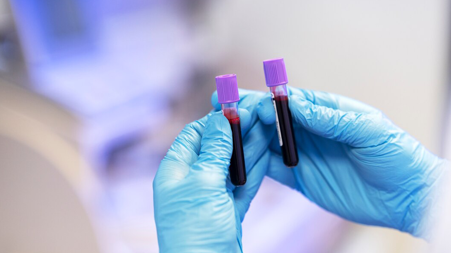 Laboratorijska dijagnostika: Ključna uloga u modernoj medicini i osnova svih ispitivanja